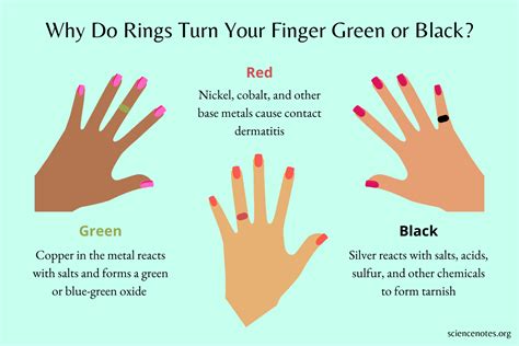 what causes rings to turn fingers green|finger turned green from ring.